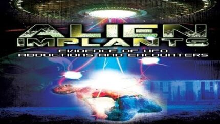 Alien Implants: Evidence of UFO Abductions and Encounters!