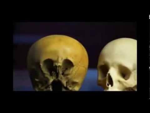 Ancient Aliens extract: the Starchild Skull
