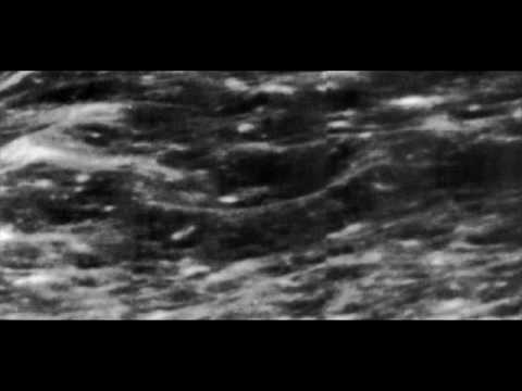 Undeniable Structures and Anomalies on the Moon via Lunar Orbiter 1, 1966