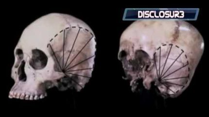 Starchild Skull- The SHOCKING DNA Results Are In….WATCH THIS! *HD*