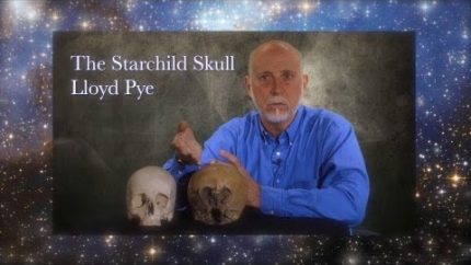 Starchild Skull DNA is Alien – Lloyd Pye