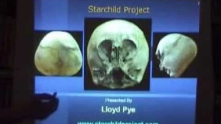 Star Child Skull Analysis by Lloyd Pye