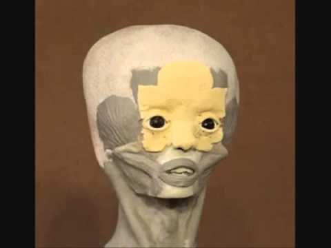 UFO Extraterestrial Star Child Skull reconstruction