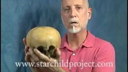Starchild Skull Bone Discussed