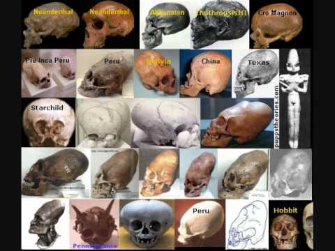 The Starchild Skull-Lloyd Pye-Everything You Know Is Wrong