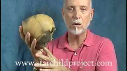 Starchild Skull Brain Discussed