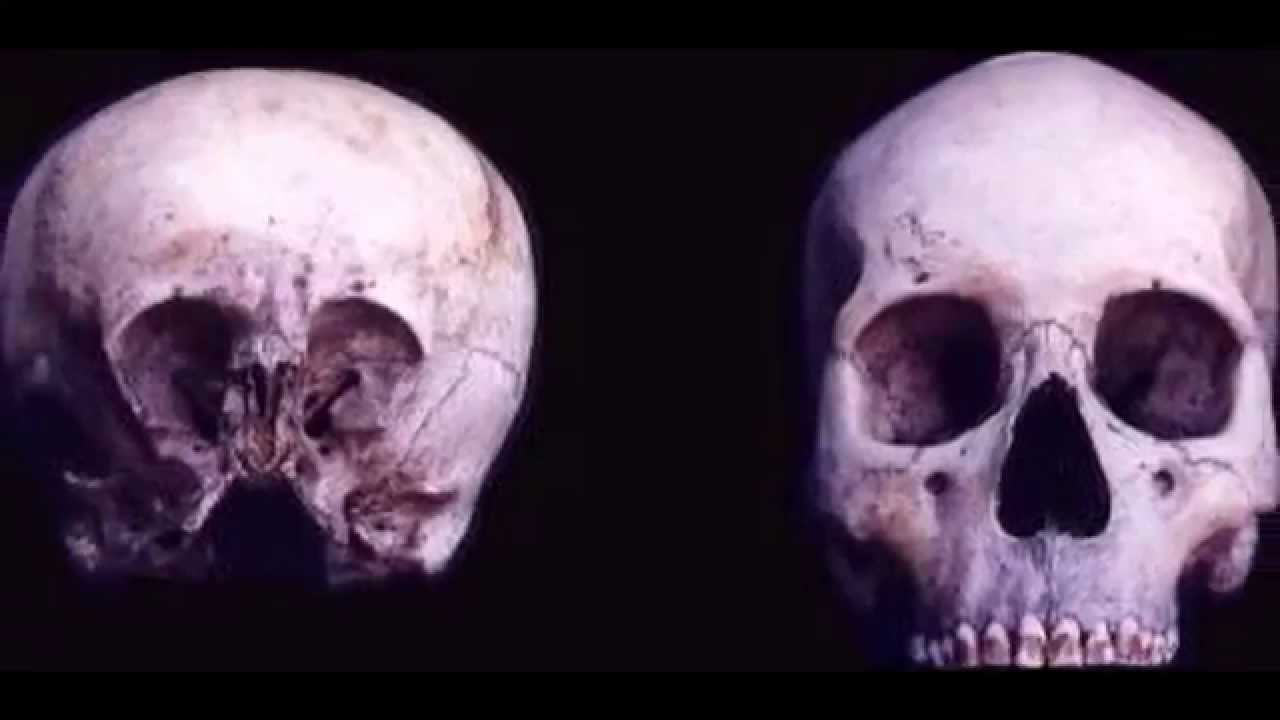 El cráneo del niño de las estrellas (Starchild skull)