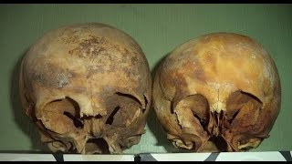 The Star Children Skulls Of Peru
